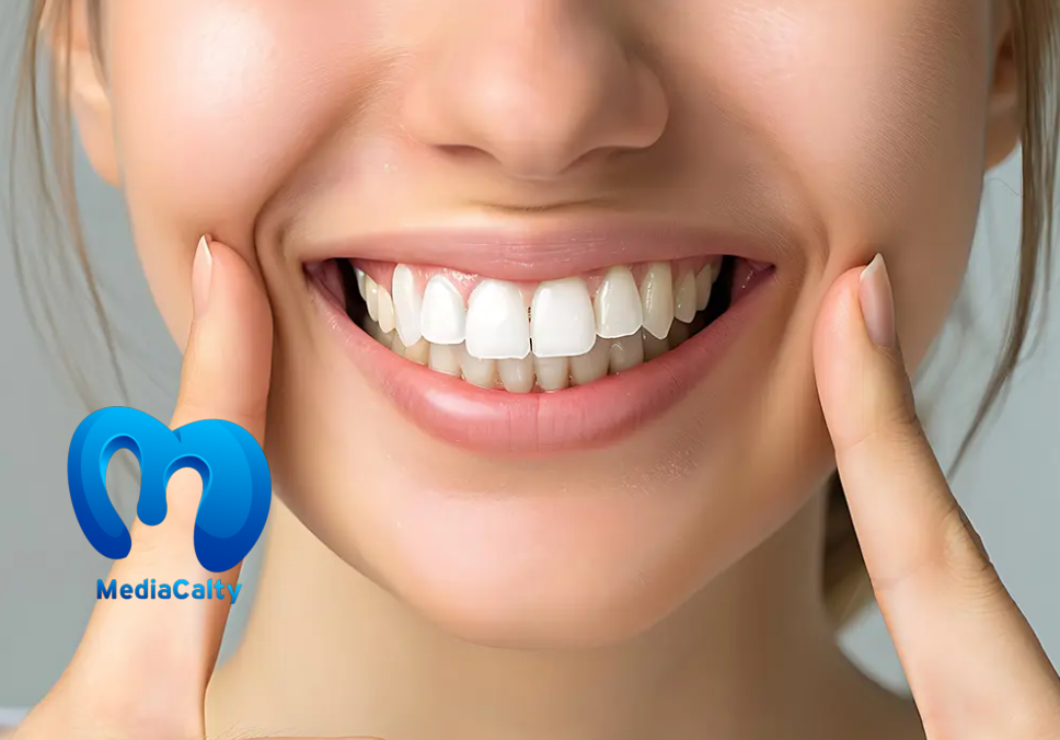 كيف أحصل على ابتسامة هوليود في السعودية؟