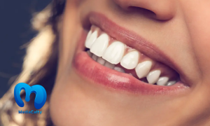 كيف تحافظ على ابتسامة هوليود لأطول فترة ممكنة؟
