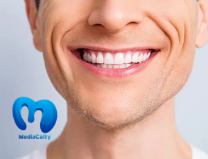 ما هي ابتسامة هوليود؟ خطوات وفوائد يجب أن تعرفها